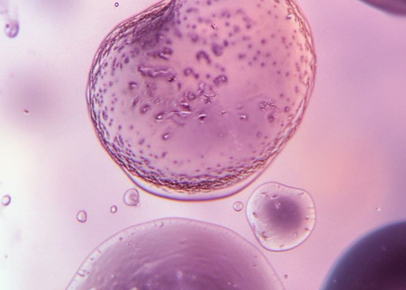 Acide hyaluronique : l’actif hydratant et repulpant pour une peau ferme et éclatante