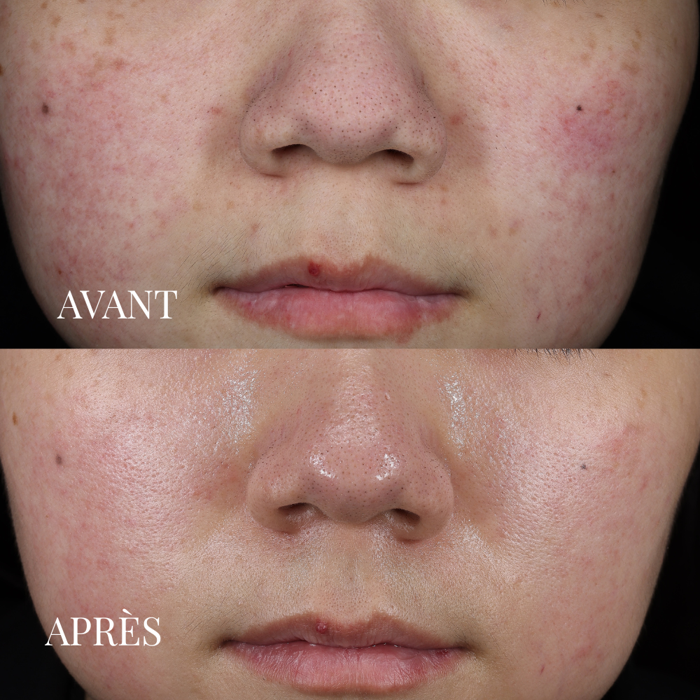 Masque Soin Détoxifiant