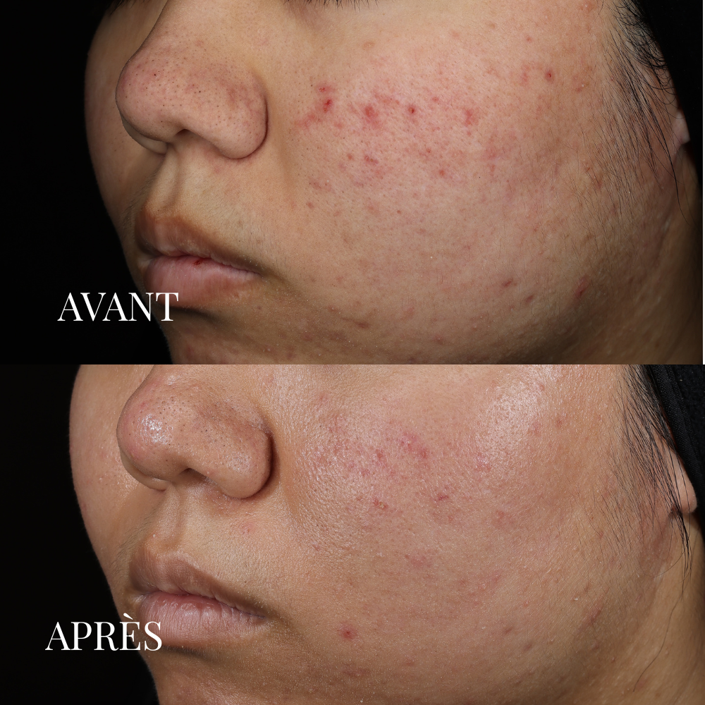 Masque Soin Détoxifiant